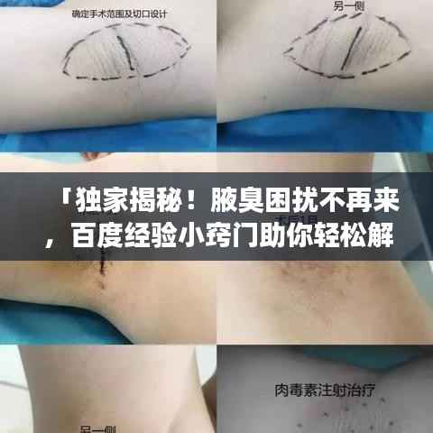 「独家揭秘!腋臭困扰不再来,百度经验小窍门助你轻松解决!」