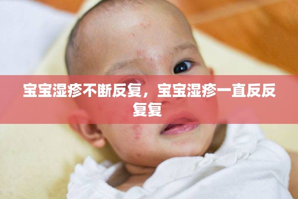 宝宝湿疹不断反复,宝宝湿疹一直反反复复
